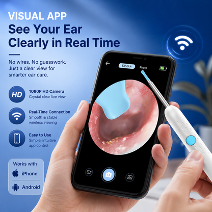 ⏰ 55% OFF Today | 👂1080P HD Wireless Ear Cleaner with Camera & Wi-Fi 📱