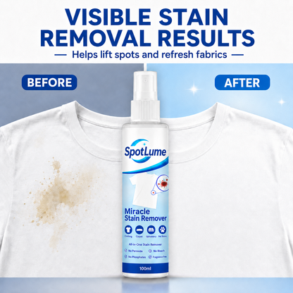 🧼All-in-One Stain Remover Spray ✨ For Clothes, Sofas, Carpets & Pet Messes