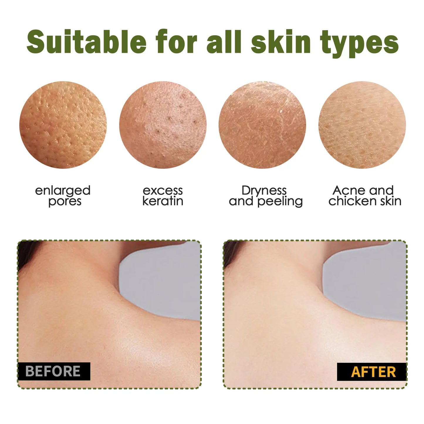 ✨50% OFF TODAY🧤 Exfoliating Gloves – Instantly Remove Dead Skin