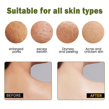 ✨50% OFF TODAY🧤 Exfoliating Gloves – Instantly Remove Dead Skin