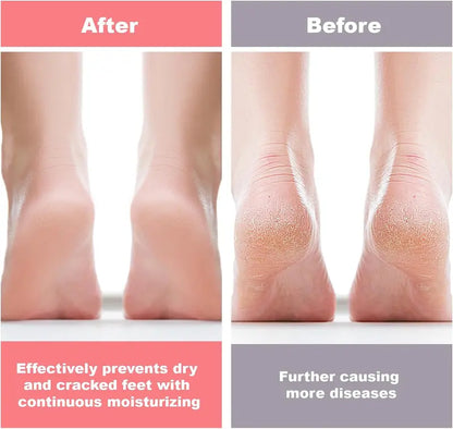 Silicone Protective Moisturizing Foot Socks for Foot Care