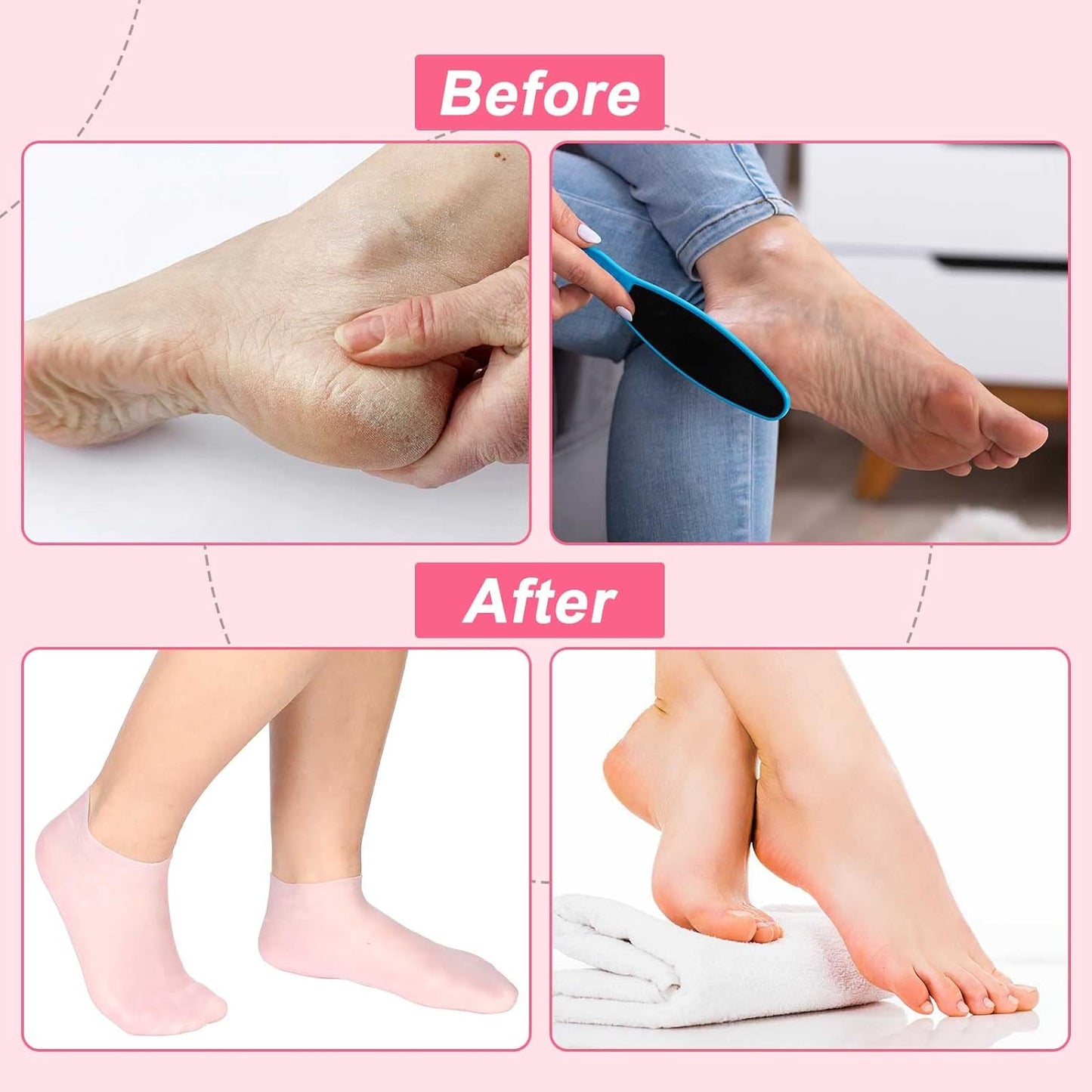 💗3-Pack Reusable Moisturizing Silicone Foot Mask Socks