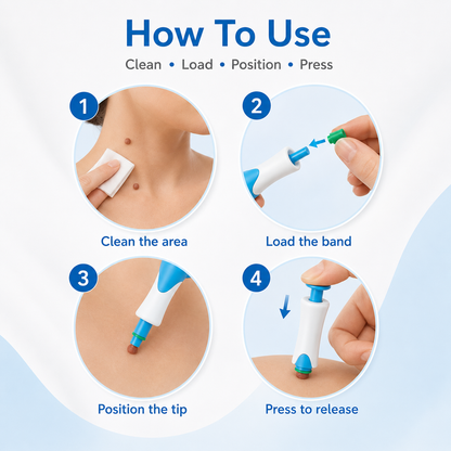 🩹 2-in-1 Auto Band Skin Tag Removal Kit – Dual Size Home Applicator ✨