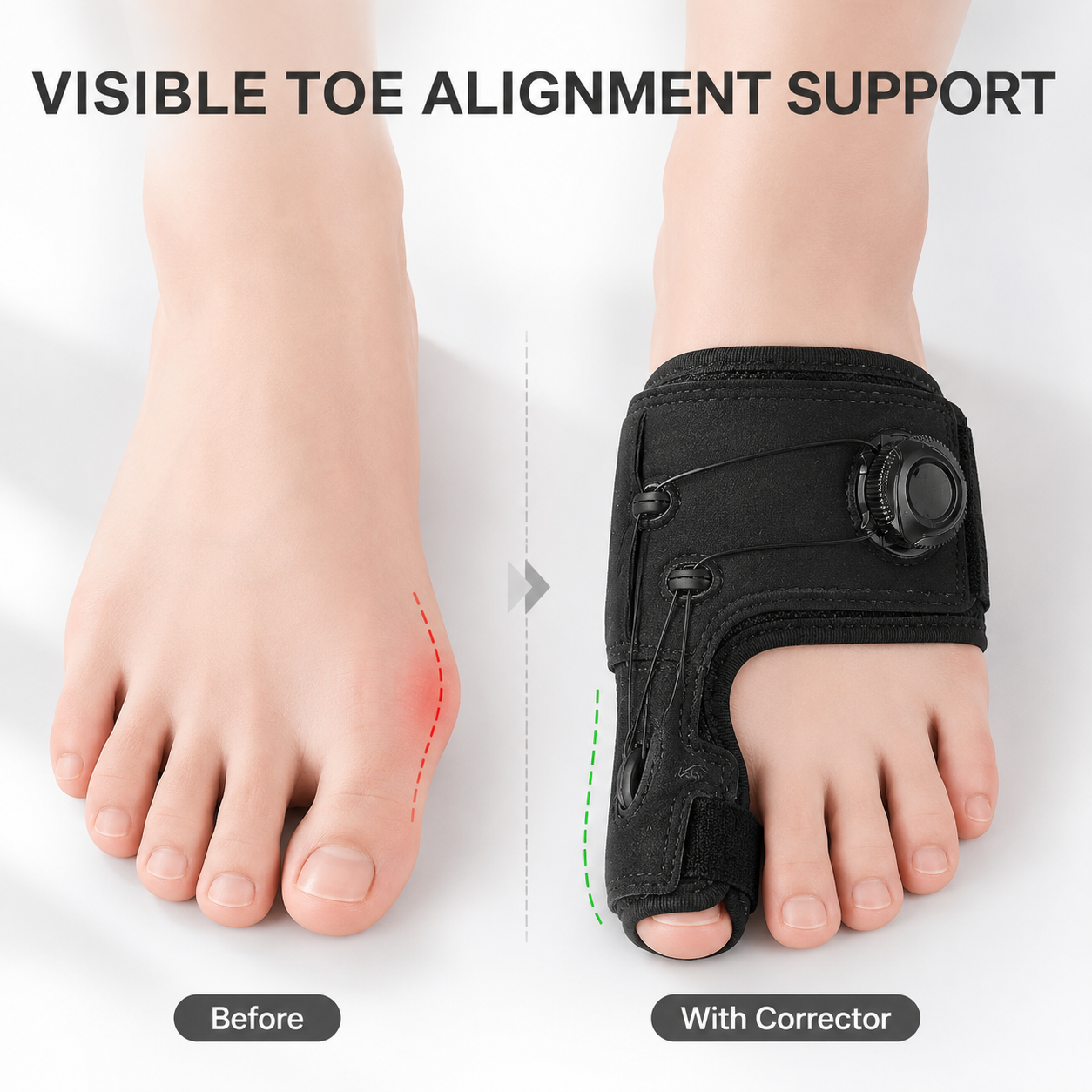 👣50% OFF TODAY✨ Bunion Relief Toe Corrector