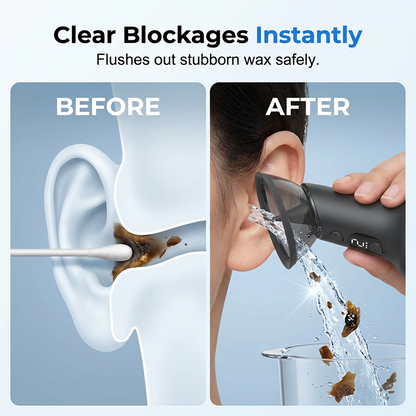 👂 Pulse Electric Ear Cleaner – Gentle Water Rinse Ear Care Tool 💧