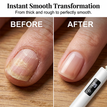 ✨50% OFF TODAY💅 Electric Nail Grinder – Transform Thick Rough Nails