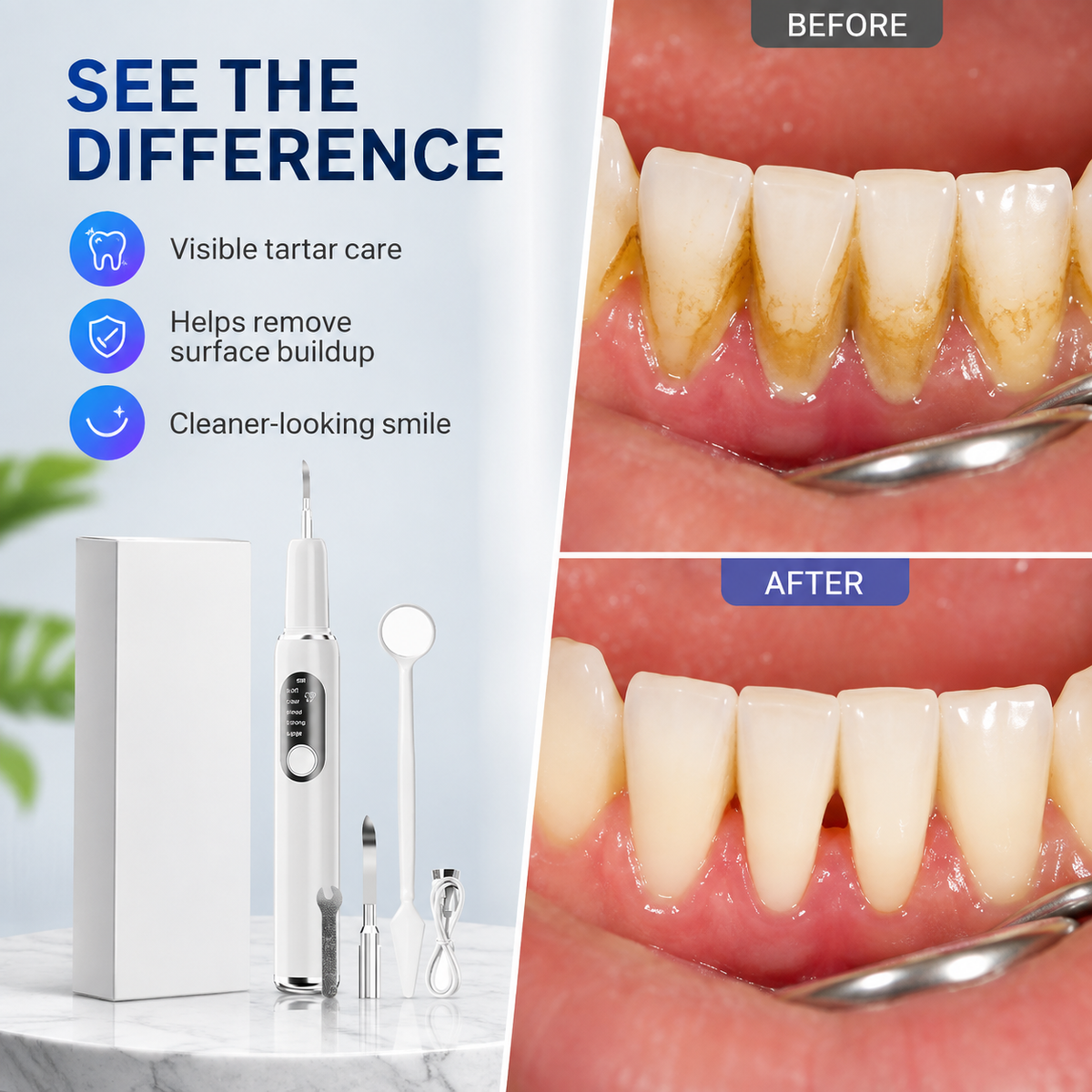 🦷 T6 Ultrasonic Teeth Cleaner – 5-Mode Tartar & Plaque Removal Kit ✨
