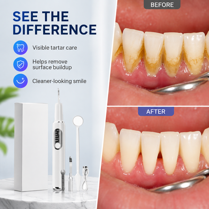 🦷 T6 Ultrasonic Teeth Cleaner – 5-Mode Tartar & Plaque Removal Kit ✨